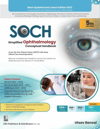 Book cover number 1 for SOCH Simplified Ophthalmology Conceptual Handbook written by Utsav Bansal published by CBS Publishers & Distributors Pvt. Ltd.